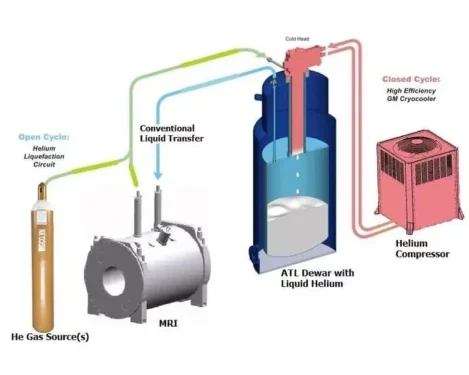 Ứng dụng khí Heli với máy chụp cộng hưởng MRI