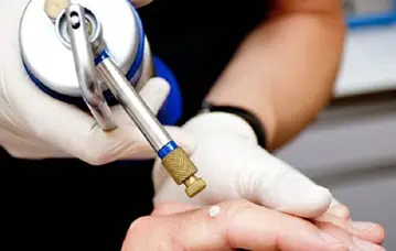 sử dụng khí nitơ trong y tế